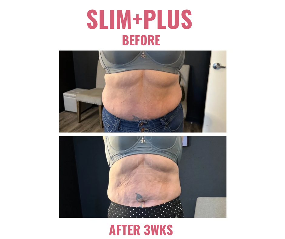 Slim+Plus "Rapid Results" Kit